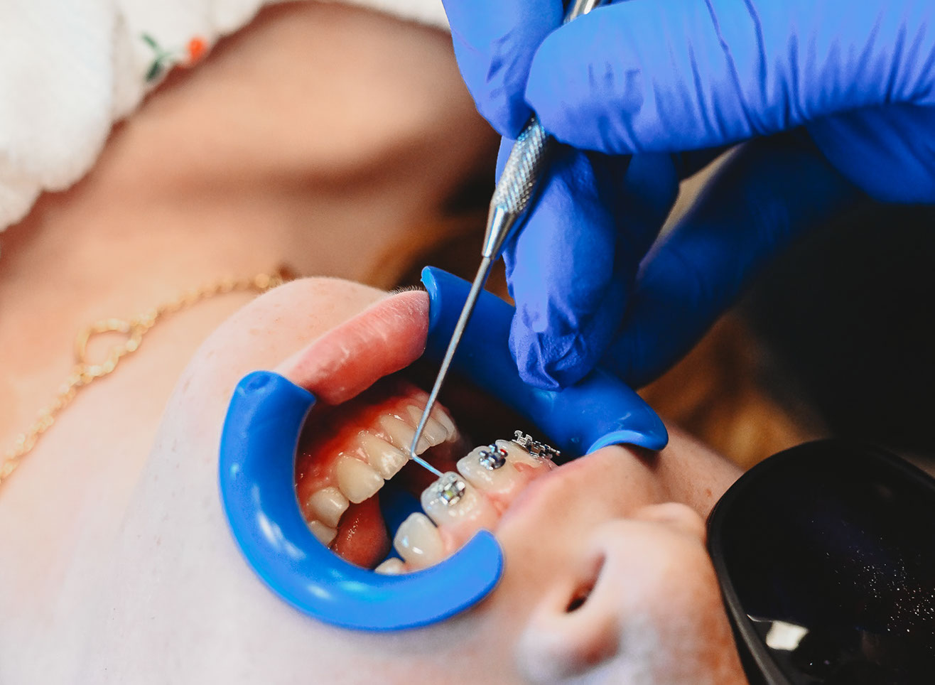 Dr Steven O'Hara | Mavericks Orthodontics in Fresno, Reedley